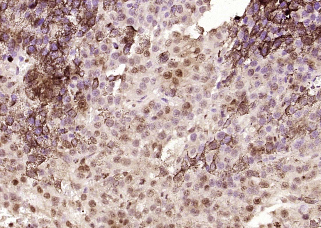 14 - SPANX Rabbit pAb AP58572