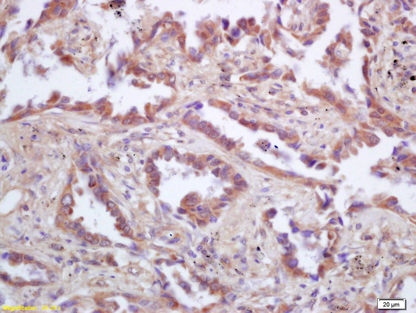 14 - p53AIP1 Rabbit pAb AP58591