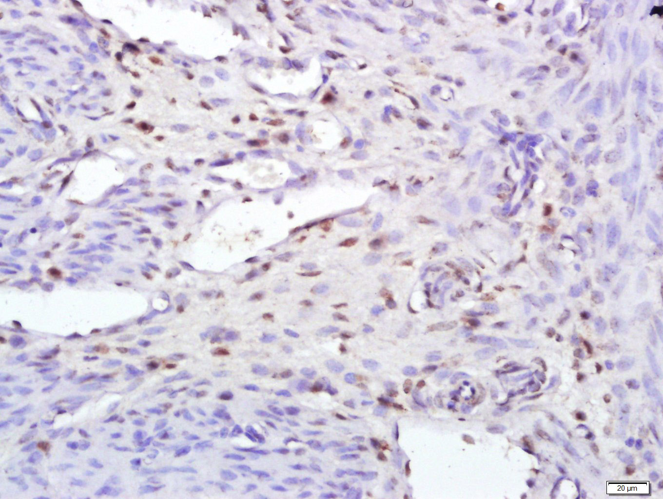 14 - TIA1 Rabbit pAb AP58597