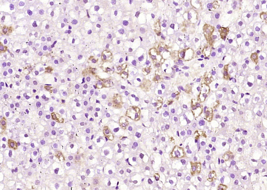 14 - PARP4 Rabbit pAb AP58599