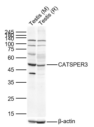 1 - CATSPER3 Rabbit pAb AP58605