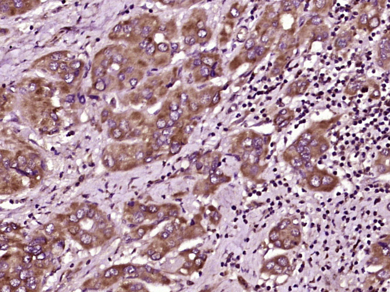 14 - MAL2 Rabbit pAb AP58622