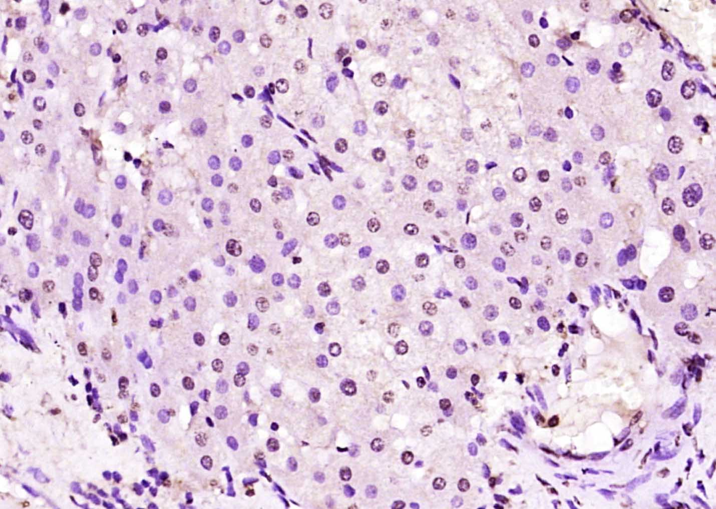 14 - ZNF229 Rabbit pAb AP58628