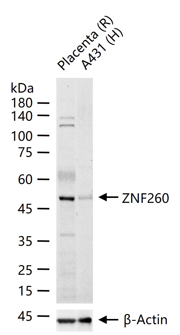 1 - ZNF260 Rabbit pAb AP58633