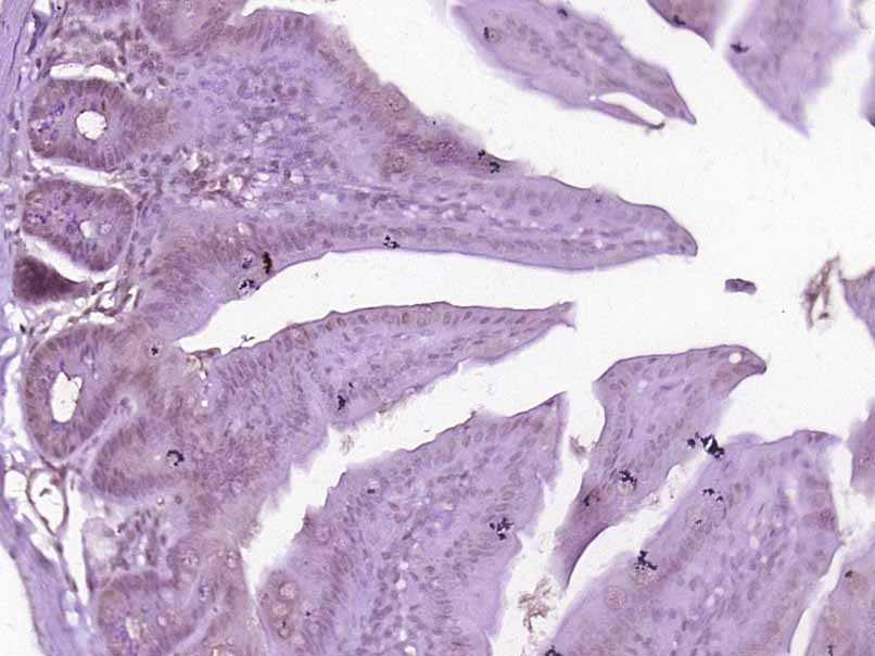 14 - ZNF408 Rabbit pAb AP58640