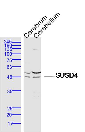 1 - SUSD4 Rabbit pAb AP58646