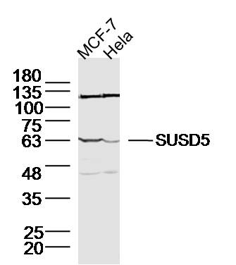 1 - SUSD5 Rabbit pAb AP58647