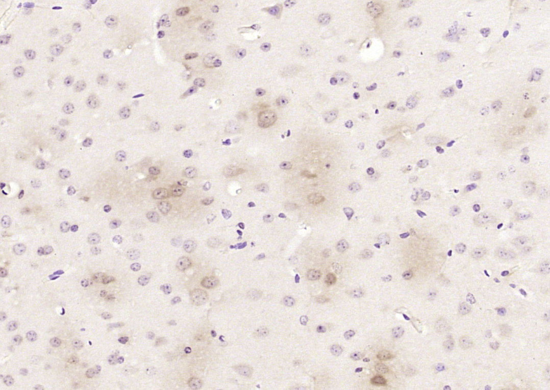 14 - Limd1 Rabbit pAb AP58648