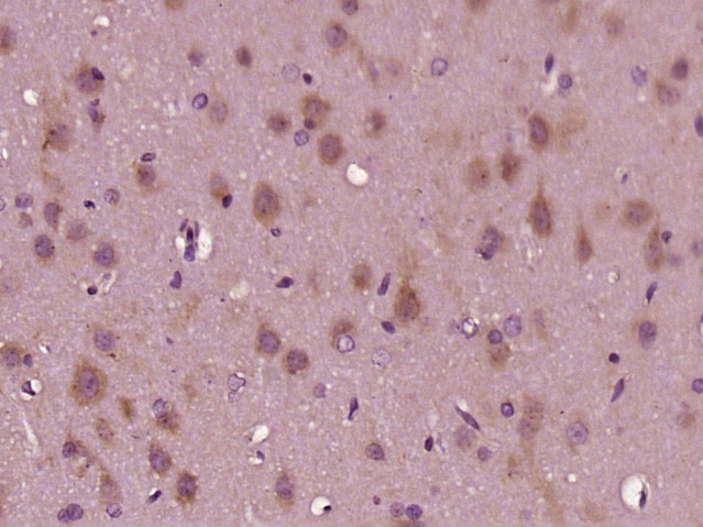 14 - Tankyrase 2 Rabbit pAb AP58658