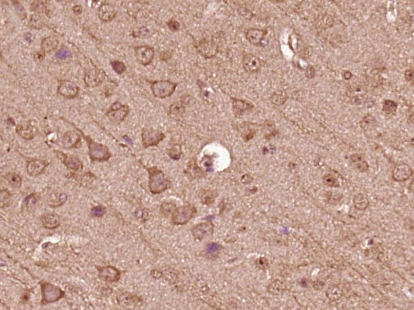 14 - TBC1D15 Rabbit pAb AP58662