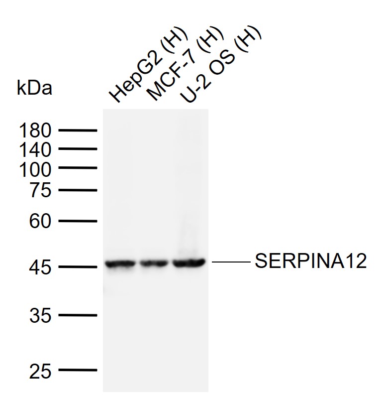 1 - SERPINA12 Rabbit pAb AP58675