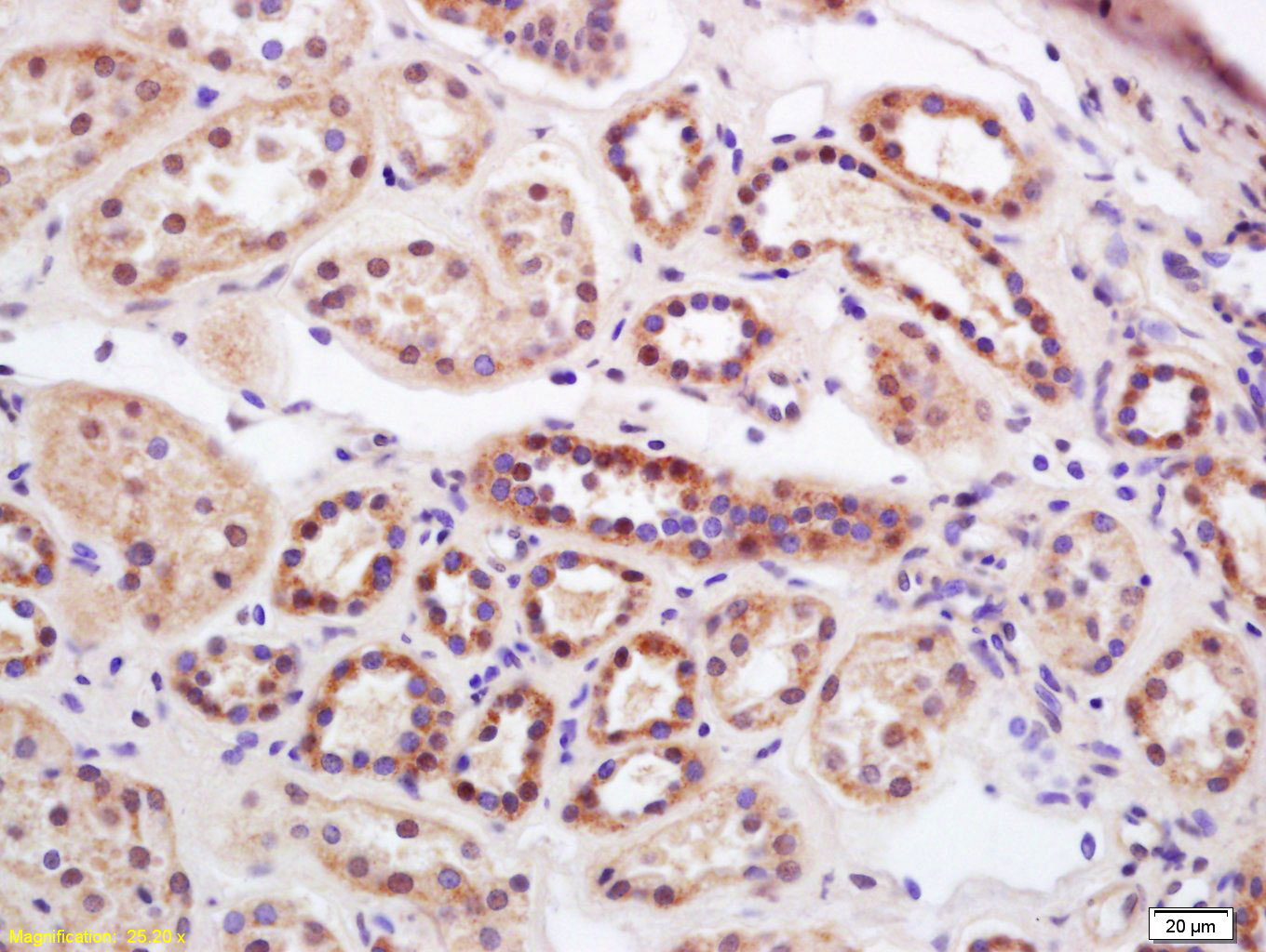14 - Serine carboxypeptidase 1 Rabbit pAb AP58676