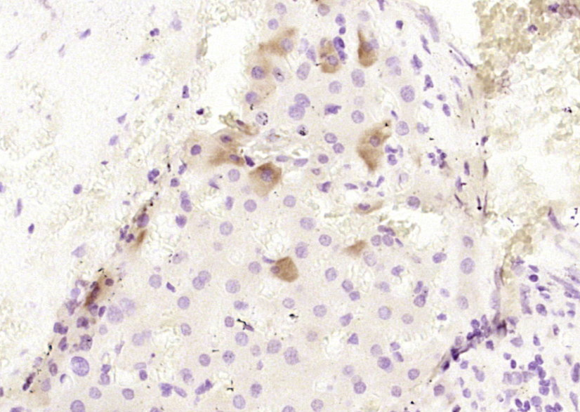 14 - CPB2 Rabbit pAb AP58677