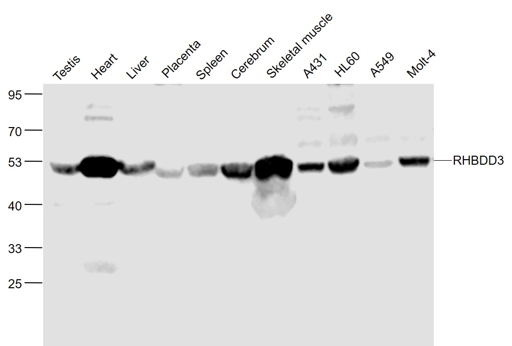 1 - RHBDD3 Rabbit pAb AP58681