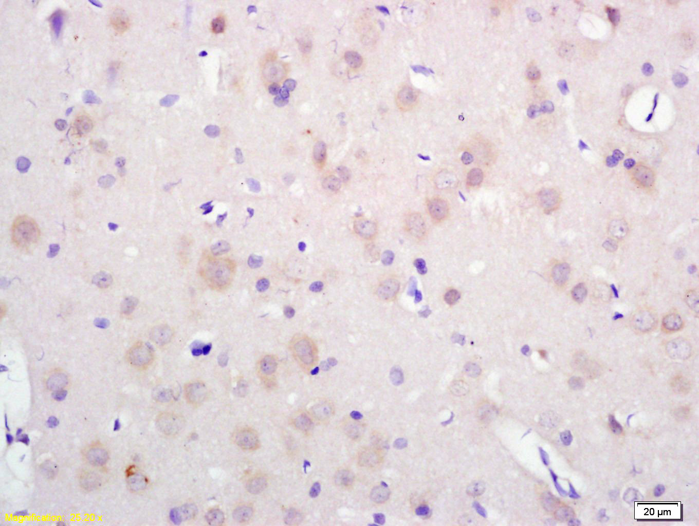 14 - SEC14 like protein 2 Rabbit pAb AP58683