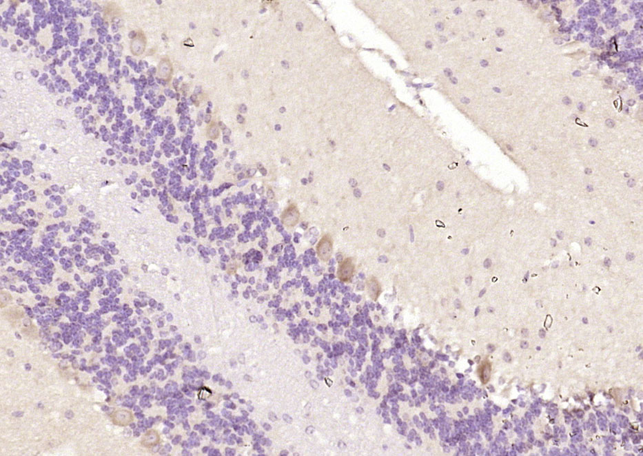 14 - Ankyrin-1 Rabbit pAb AP58687
