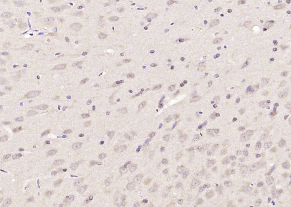 14 - LRDD Rabbit pAb AP58690