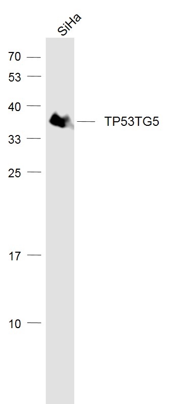 1 - TP53TG5 Rabbit pAb AP58722