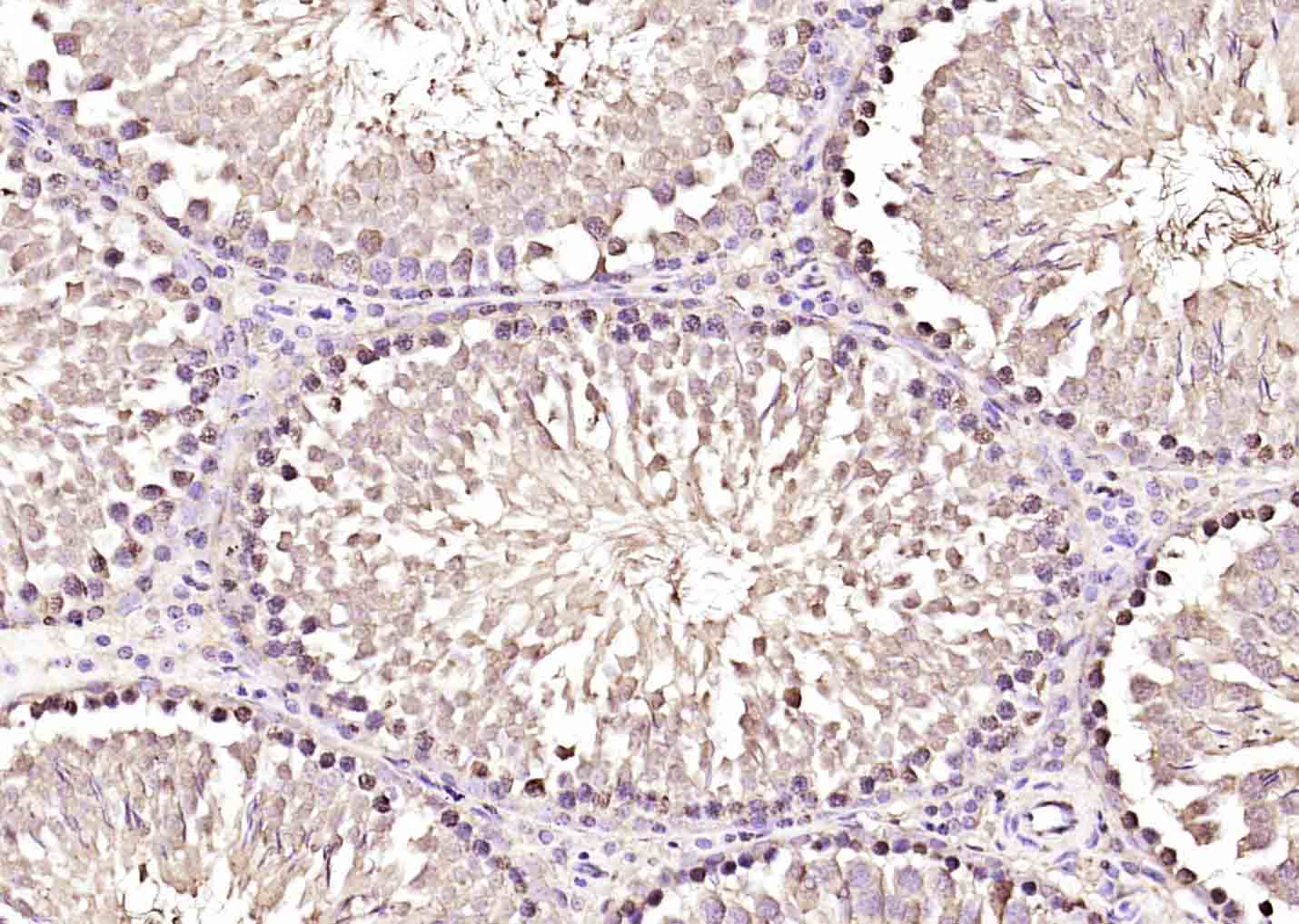 14 - TP53TG5 Rabbit pAb AP58722