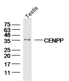1 - CENPP Rabbit pAb AP58723