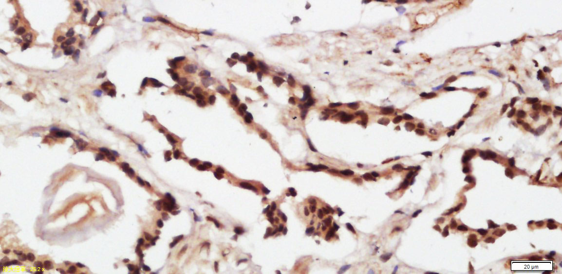 14 - CENPP Rabbit pAb AP58723