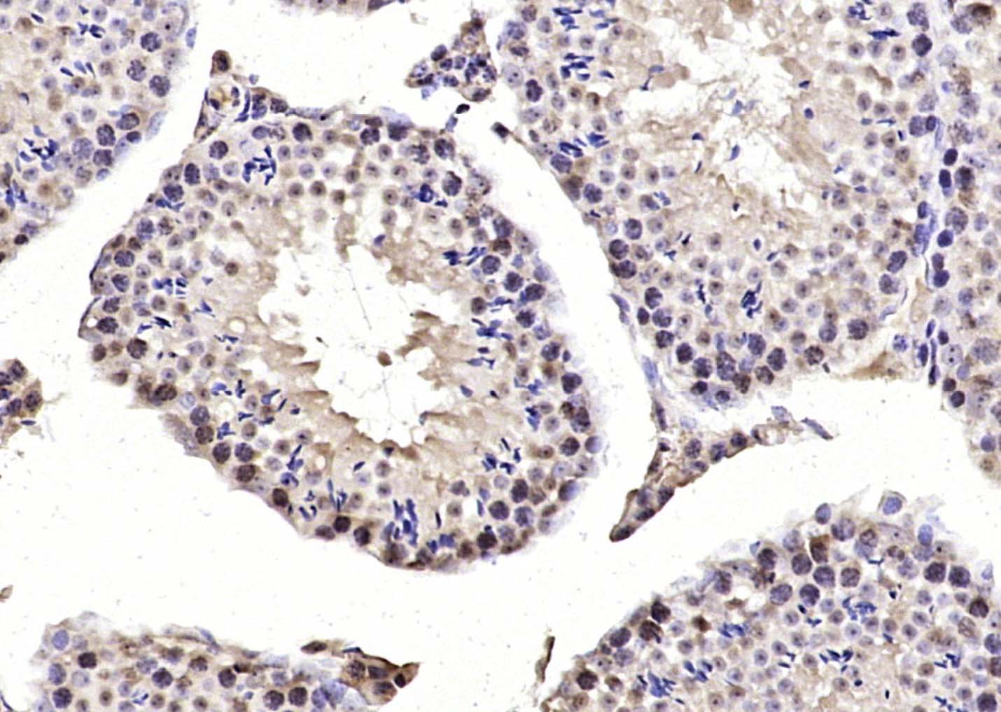 14 - MIS12 Rabbit pAb AP58726