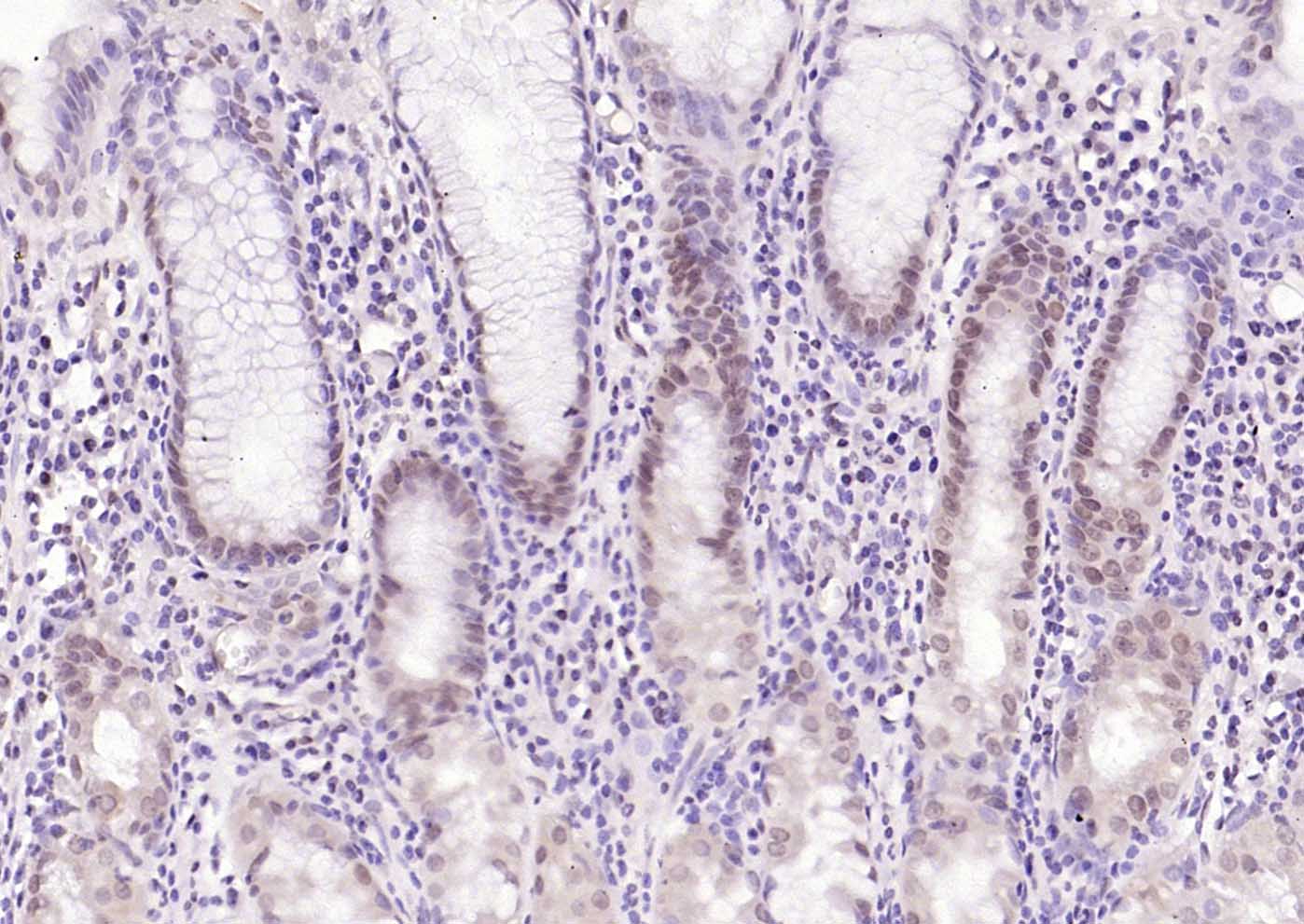 14 - CDCA5 Rabbit pAb AP58728