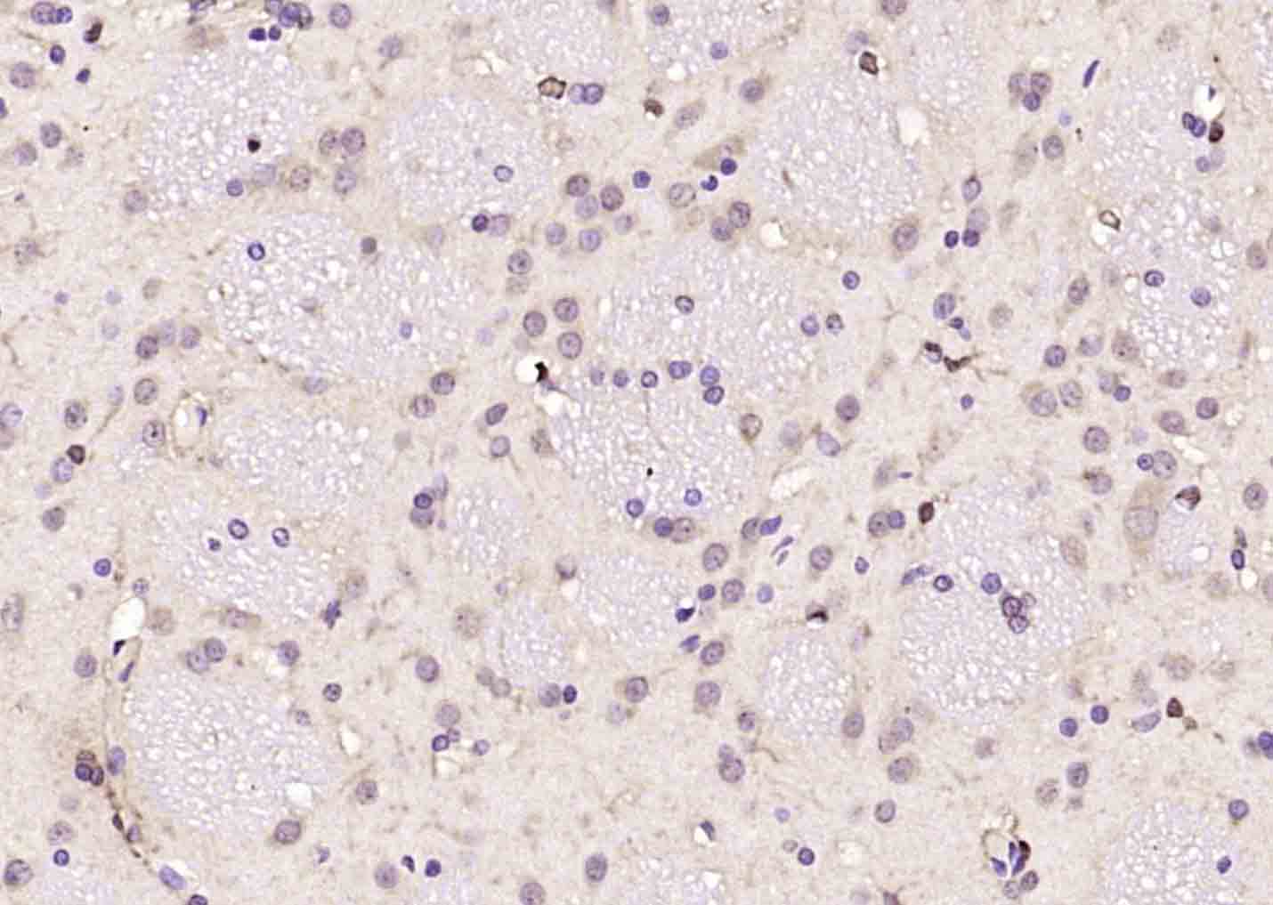 14 - SMC5 Rabbit pAb AP58733