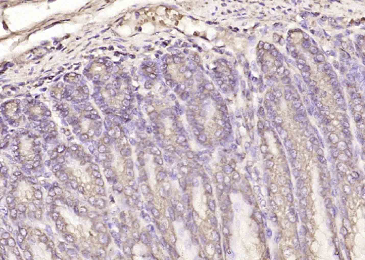 14 - SMC6 Rabbit pAb AP58734