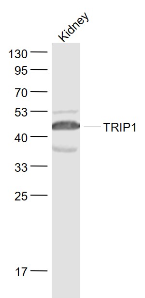 1 - TRIP1 Rabbit pAb AP58735
