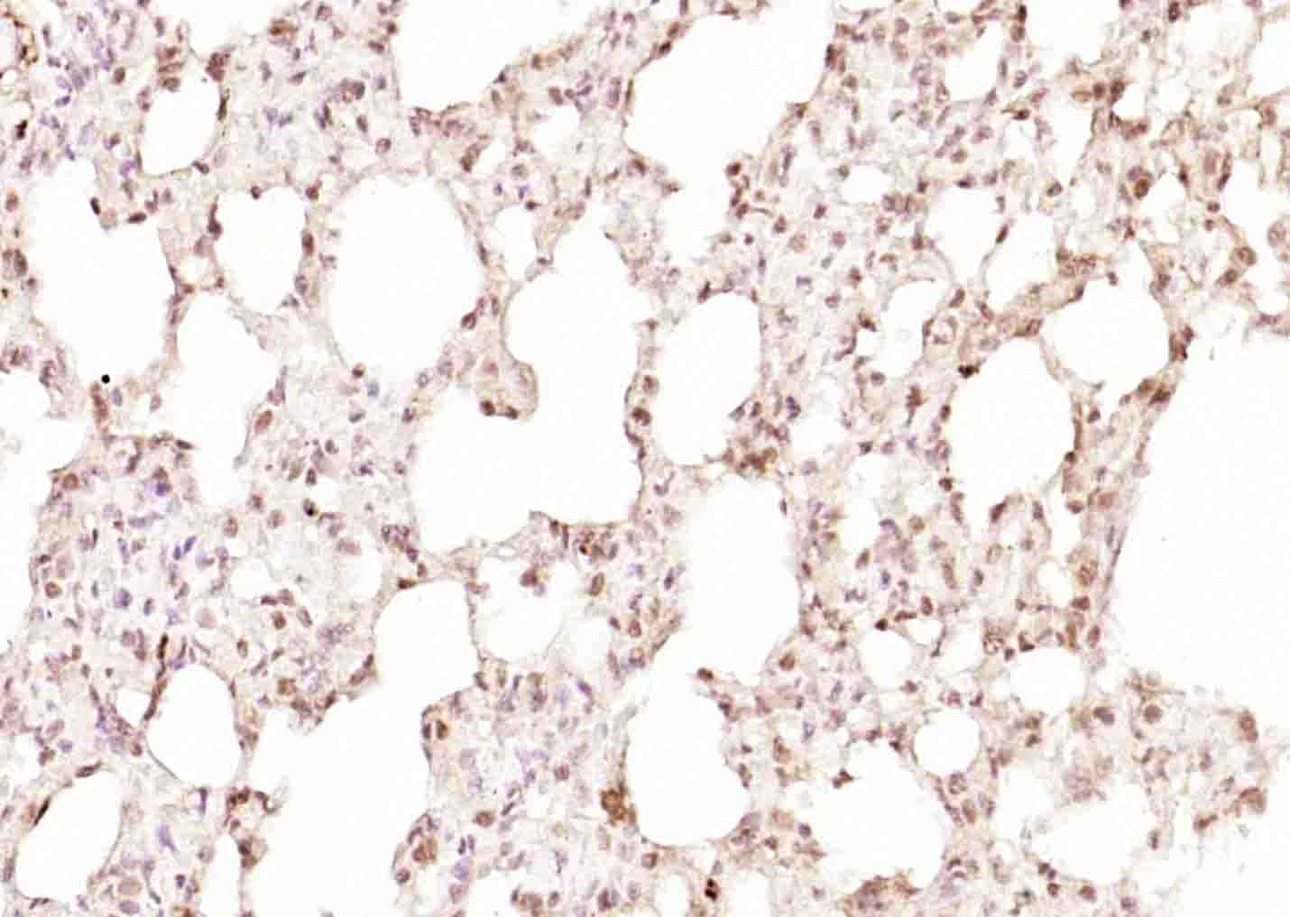 14 - TRIP1 Rabbit pAb AP58735