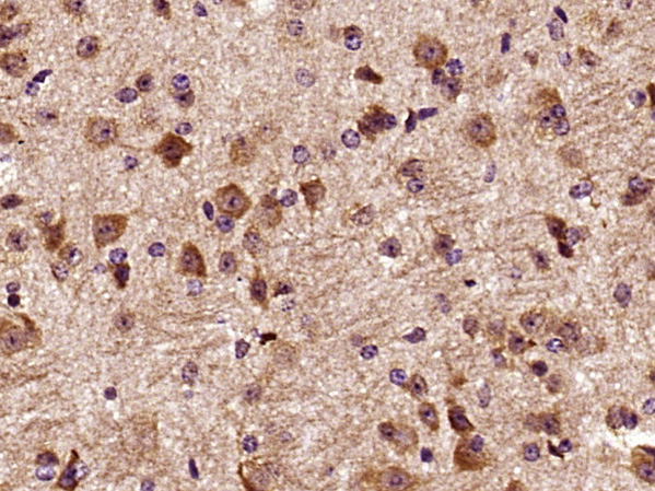 14 - DCTN3 Rabbit pAb AP58744