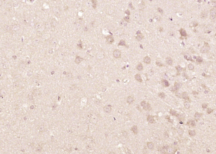 14 - HCF-1 Rabbit pAb AP58756