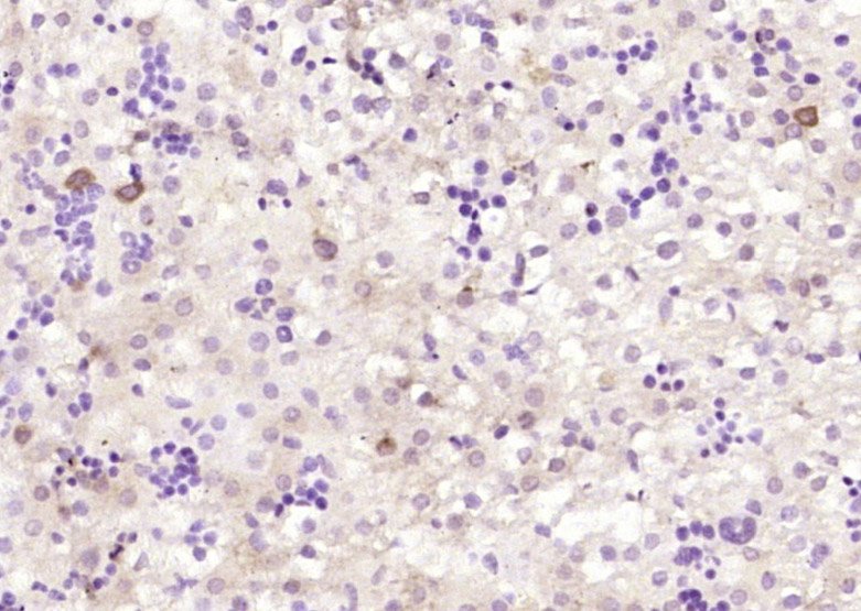 14 - KLHL22 Rabbit pAb AP58758