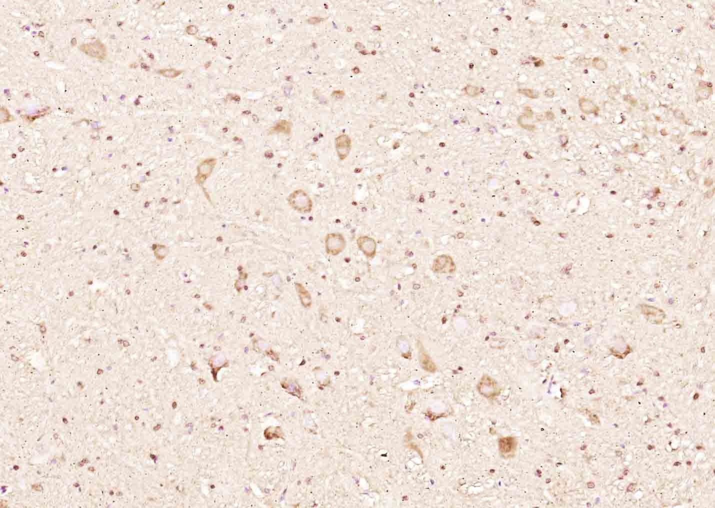 14 - RINT1 Rabbit pAb AP58768