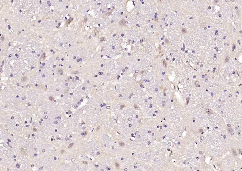 14 - FLII Rabbit pAb AP58781