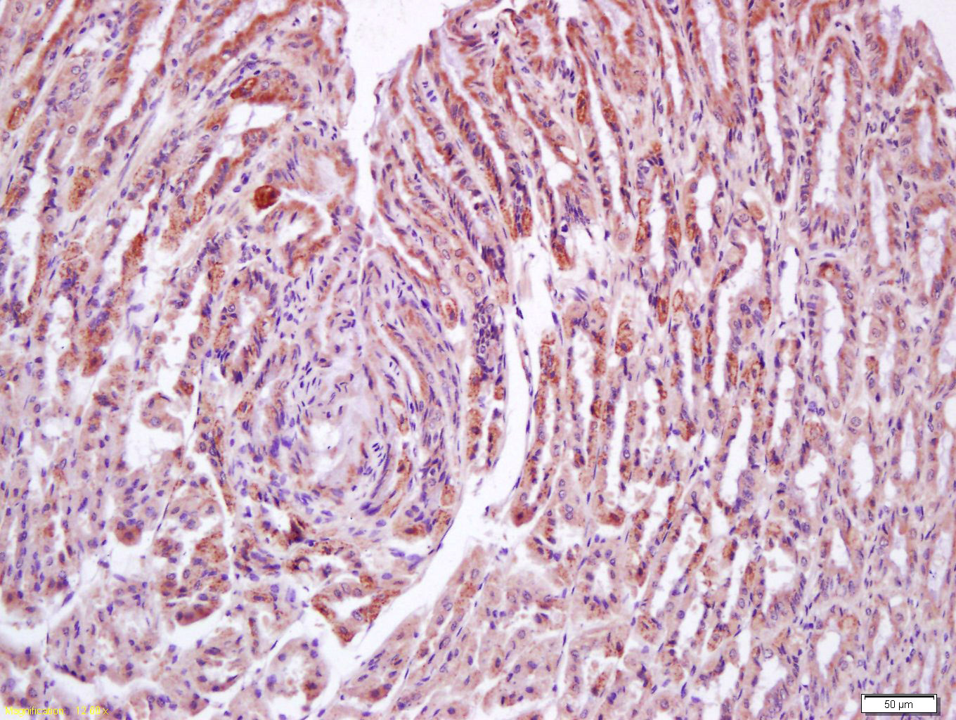 14 - N acetylglucosamine kinase Rabbit pAb AP58795