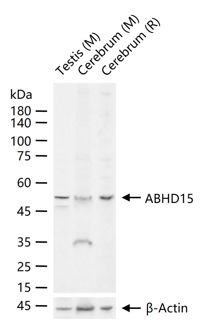 1 - ABHD15 Rabbit pAb AP58804