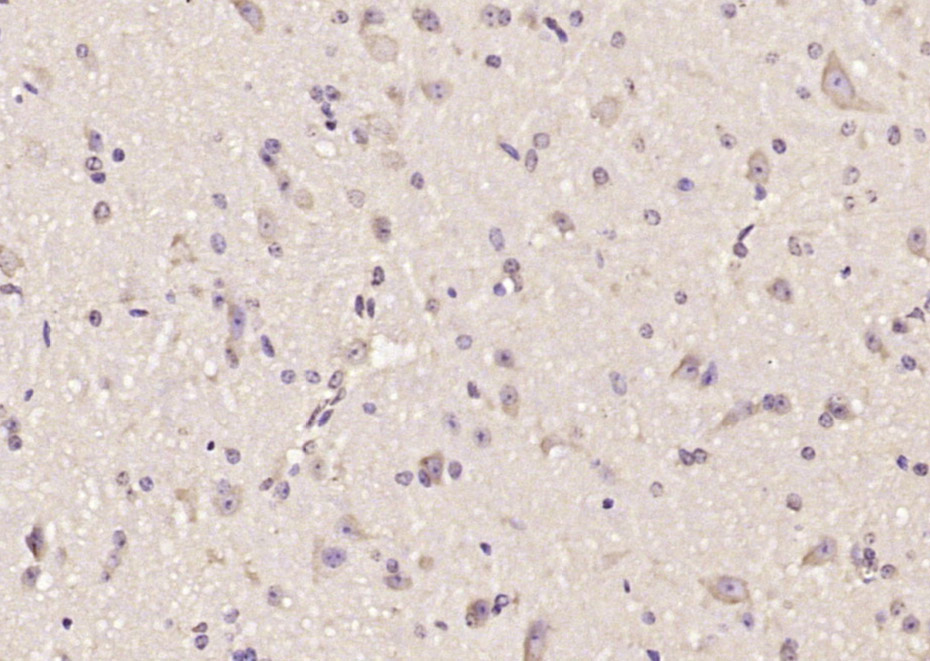 14 - AOC1 Rabbit pAb AP58806