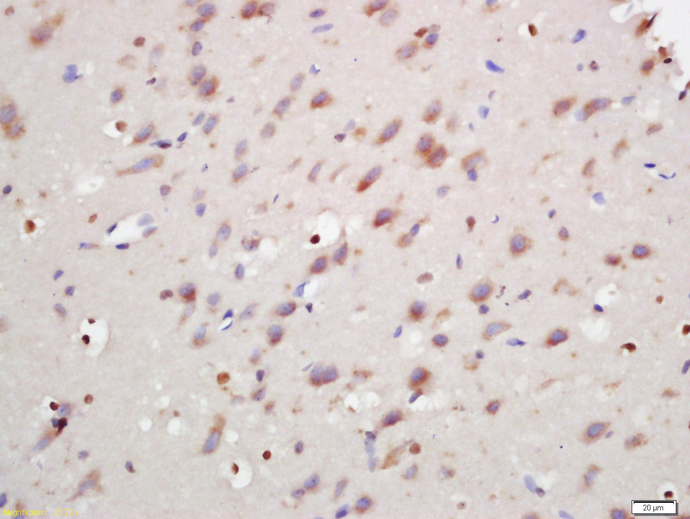 14 - ANKRD9 Rabbit pAb AP58811