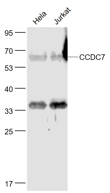 1 - CCDC7 Rabbit pAb AP58826