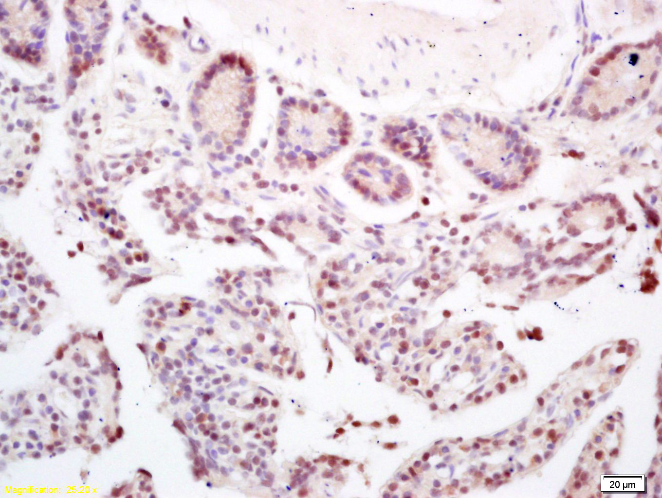 14 - CCDC7 Rabbit pAb AP58826