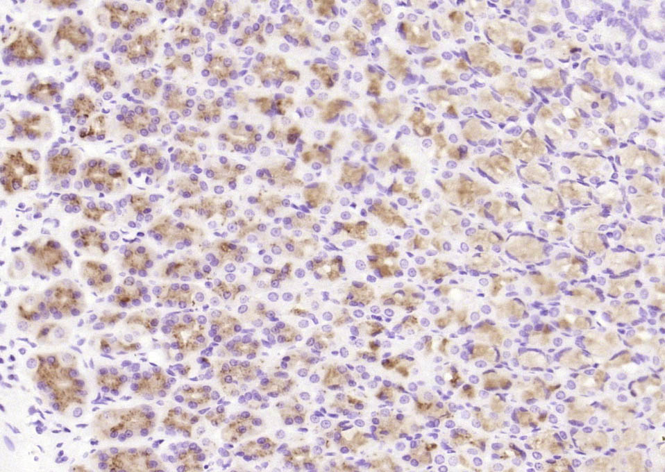 14 - CCDC80 Rabbit pAb AP58827