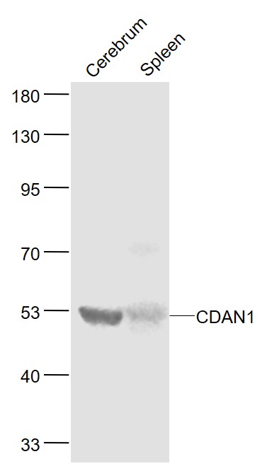 1 - CDAN1 Rabbit pAb AP58828