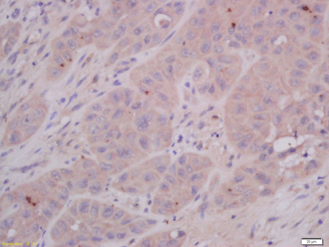 14 - COMMD4 Rabbit pAb AP58840