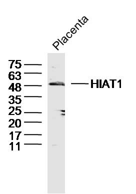 1 - HIAT1 Rabbit pAb AP58843