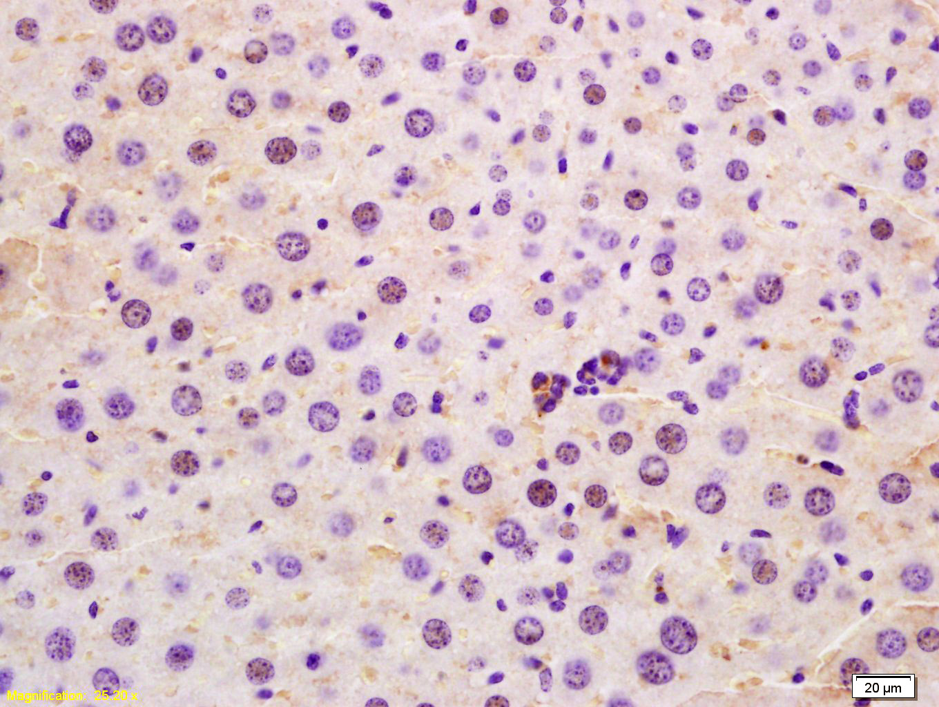 14 - SRRM2 Rabbit pAb AP58857