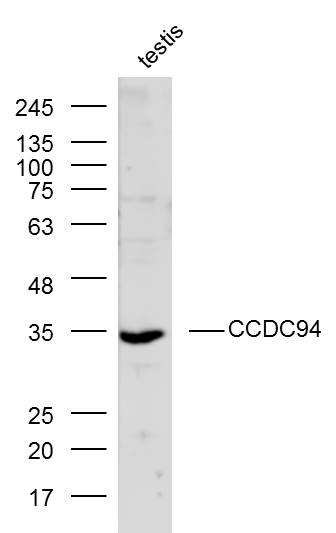1 - CCDC94 Rabbit pAb AP58861