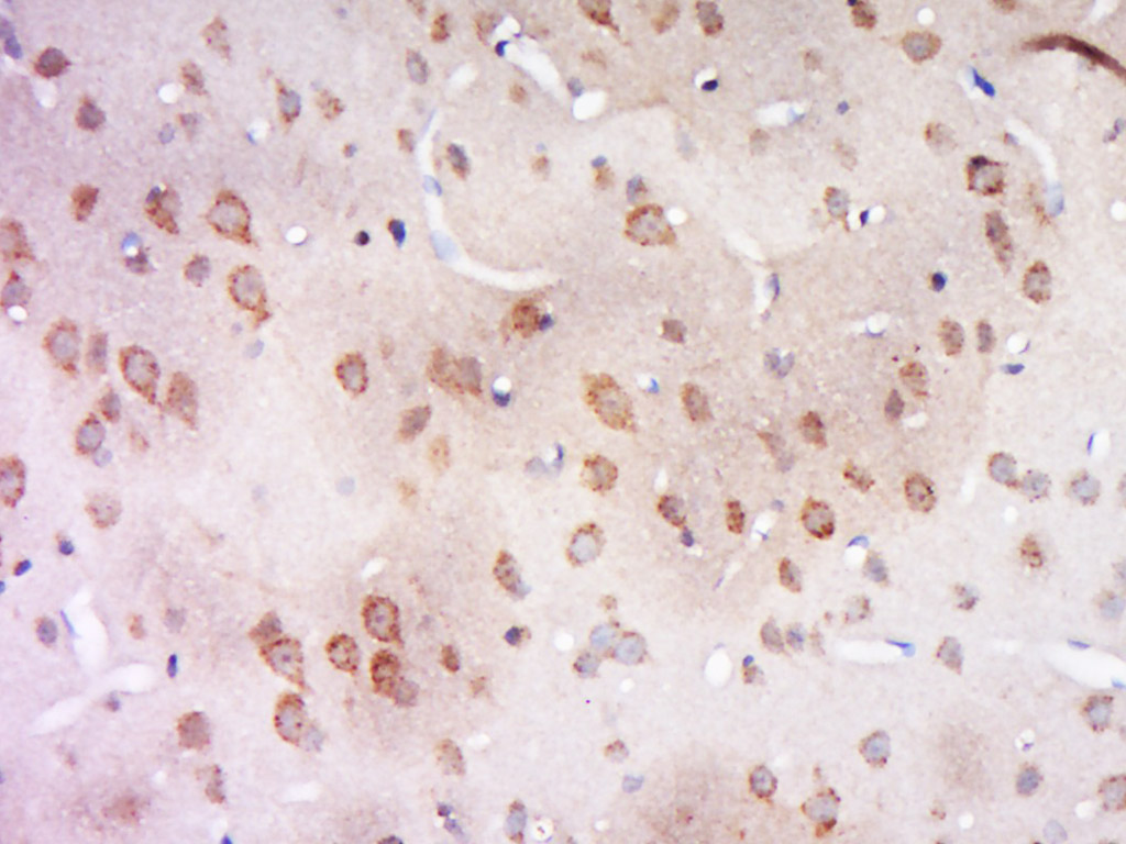 14 - CCDC94 Rabbit pAb AP58861