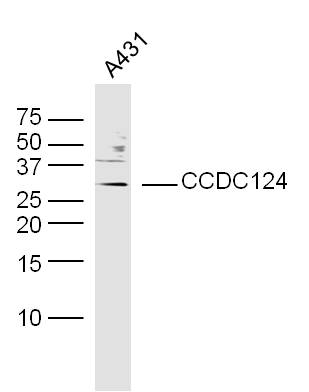 1 - CCDC124 Rabbit pAb AP58862